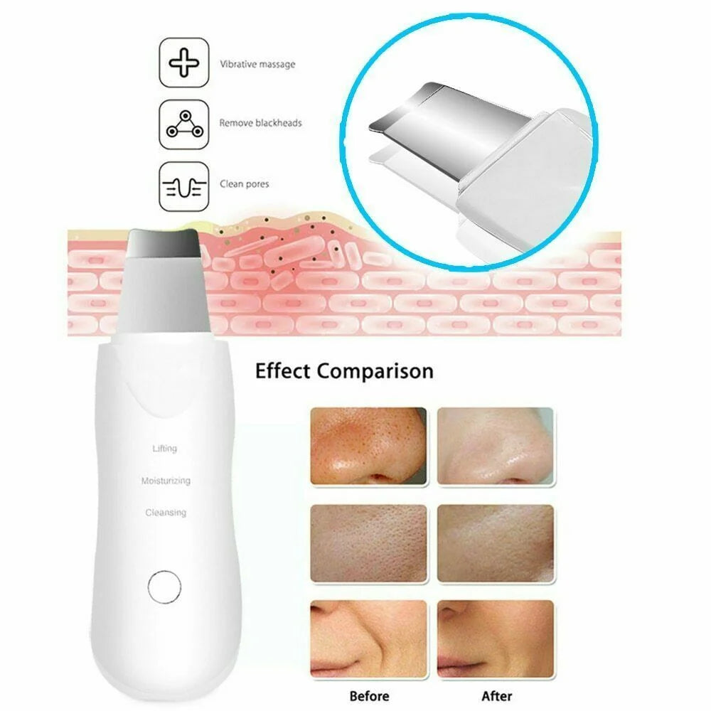 Ultrasonic Skin Scrubber Face Spatula Blackhead Remover Shovel Clean Scrubber Vibration Facial lifting Facial Iifting Skin Care
